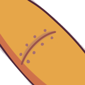 a limb with a scar bordered by scar dots from stitches